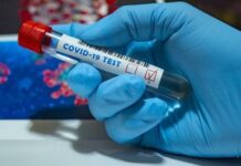 COVID-19 : 181 nouvelles contaminations recensées le 17 août 2022