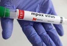 OMS: 15 pays africains touchés par le Mpox, y compris le Maroc !