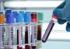 La CNAM doit régler les créances laboratoires d’analyses privés