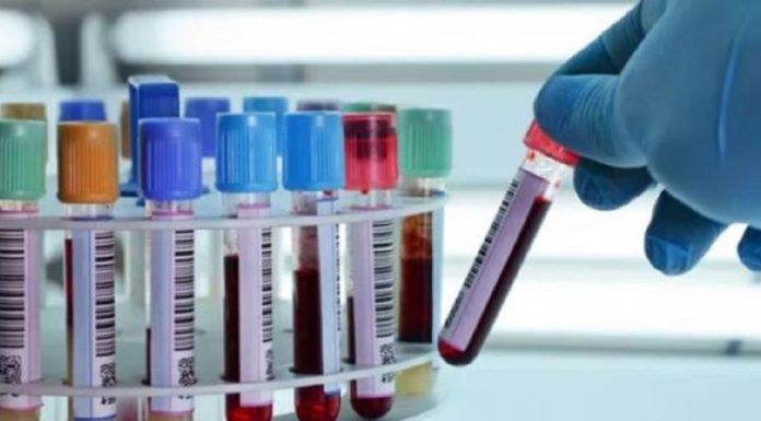 La CNAM doit régler les créances laboratoires d’analyses privés