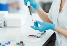 La syndicat tunisien des biologistes privés a décidé de suspendre l’application du système de tiers payant à partir du 13 juillet 2026